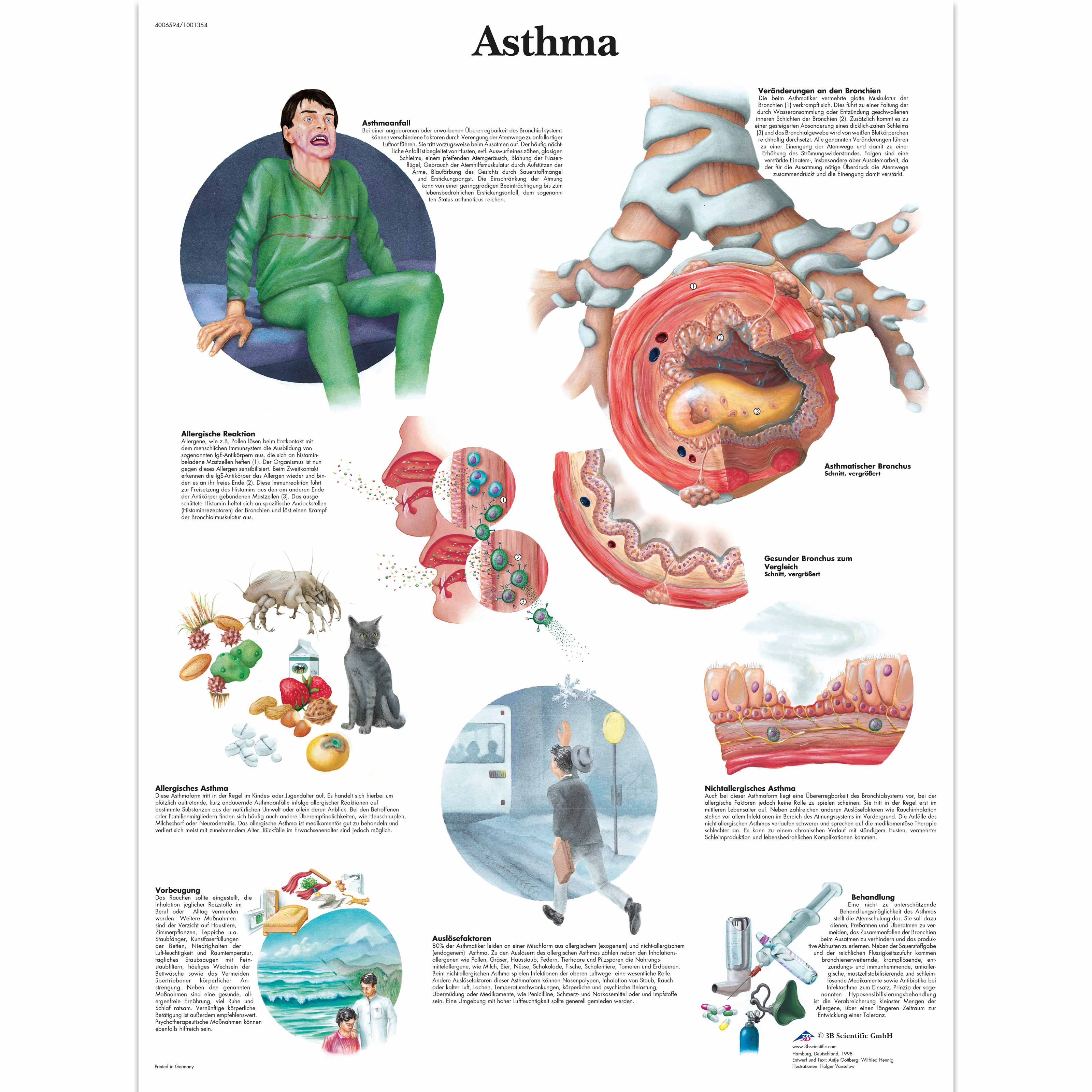 Asthma Chart 1001354 3B Scientific VR0328L Asthma Patient Education Asthma Models