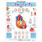 Herzinfarkt, 4006597 [VR0342UU], 心脏健康和身体健康教育示意图