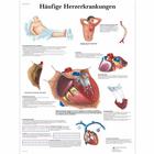 Häufige Herzerkrankungen, 1001362 [VR0343L], 心脏健康和身体健康教育示意图
