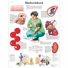 Bluthochdruck, 1001369 [VR0361L], Плакаты по кардиоваскулярной системе
