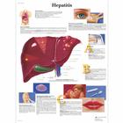 Hepatitis, 1001389 [VR0435L], Плакаты по метаболической системе