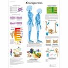 Osteoporosis, 1001472 [VR1121L], Плакаты по опорно-двигательному аппарату человека