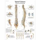 Spinal Column - Anatomy and Pathology, 1001480 [VR1152L], Плакаты по опорно-двигательному аппарату человека