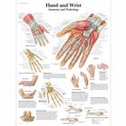 Hand and Wrist - Anatomy and Pathology, 1001484 [VR1171L], Плакаты по опорно-двигательному аппарату человека
