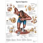 Sports Injuries, 1001494 [VR1188L], Плакаты по мышечной системе