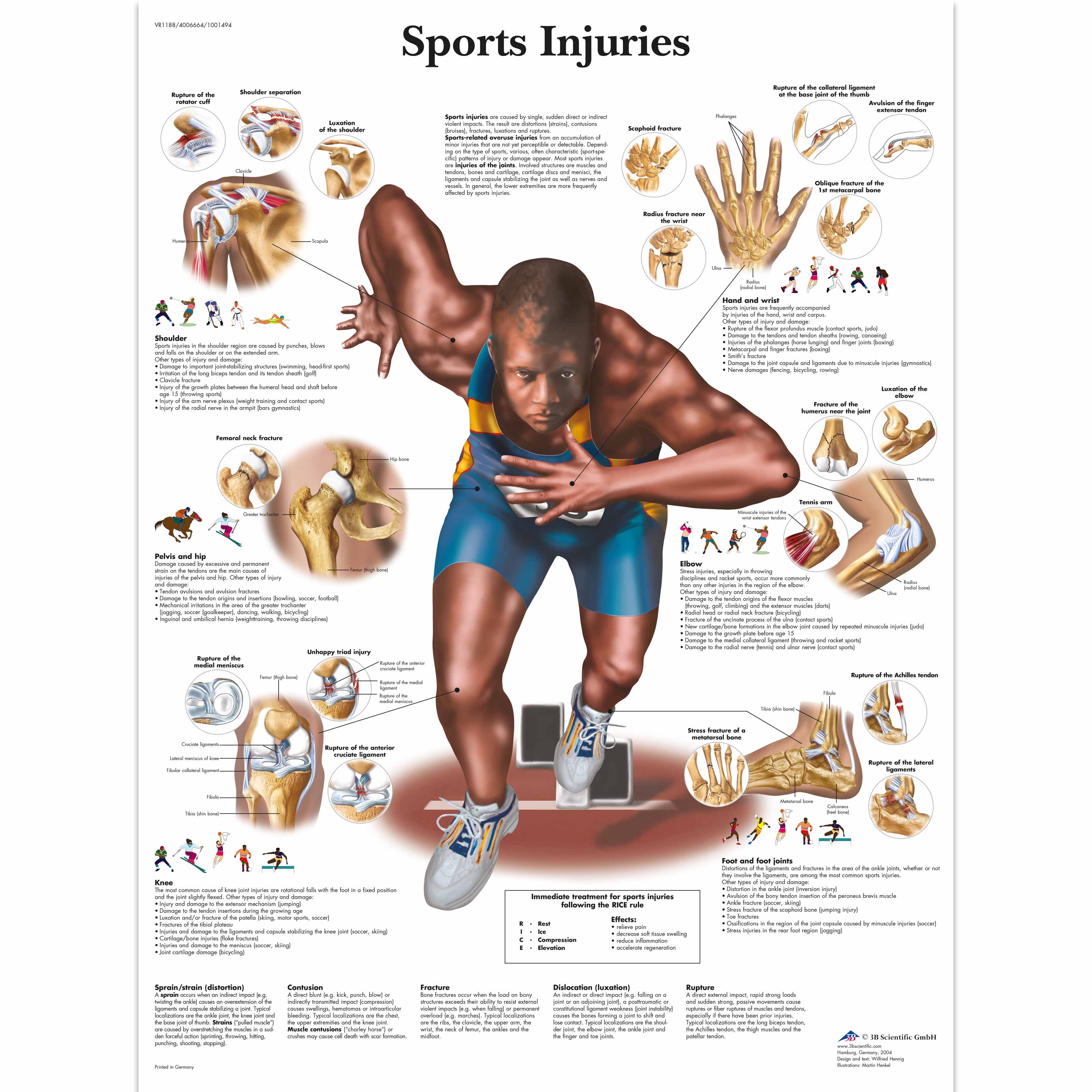 Sports Injuries Chart - 1001494 - VR1188L - Muscle - 3B Scientific
