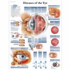 Diseases of the Eye, 4006666 [VR1231UU], Плакаты по глазам (офтальмология)