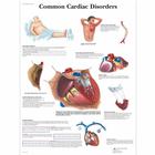 Common Cardiac Disorders, 1001526 [VR1343L], Плакаты по кардиоваскулярной системе