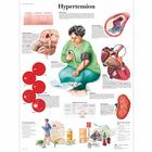 Hypertension, 1001532 [VR1361L], Плакаты по кардиоваскулярной системе
