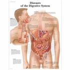 Diseases of the Digestive System, 4006691 [VR1431UU], Плакаты по пищеварительной системе