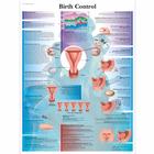 Birth Control, 1001580 [VR1591L], Плакаты по гинекологии
