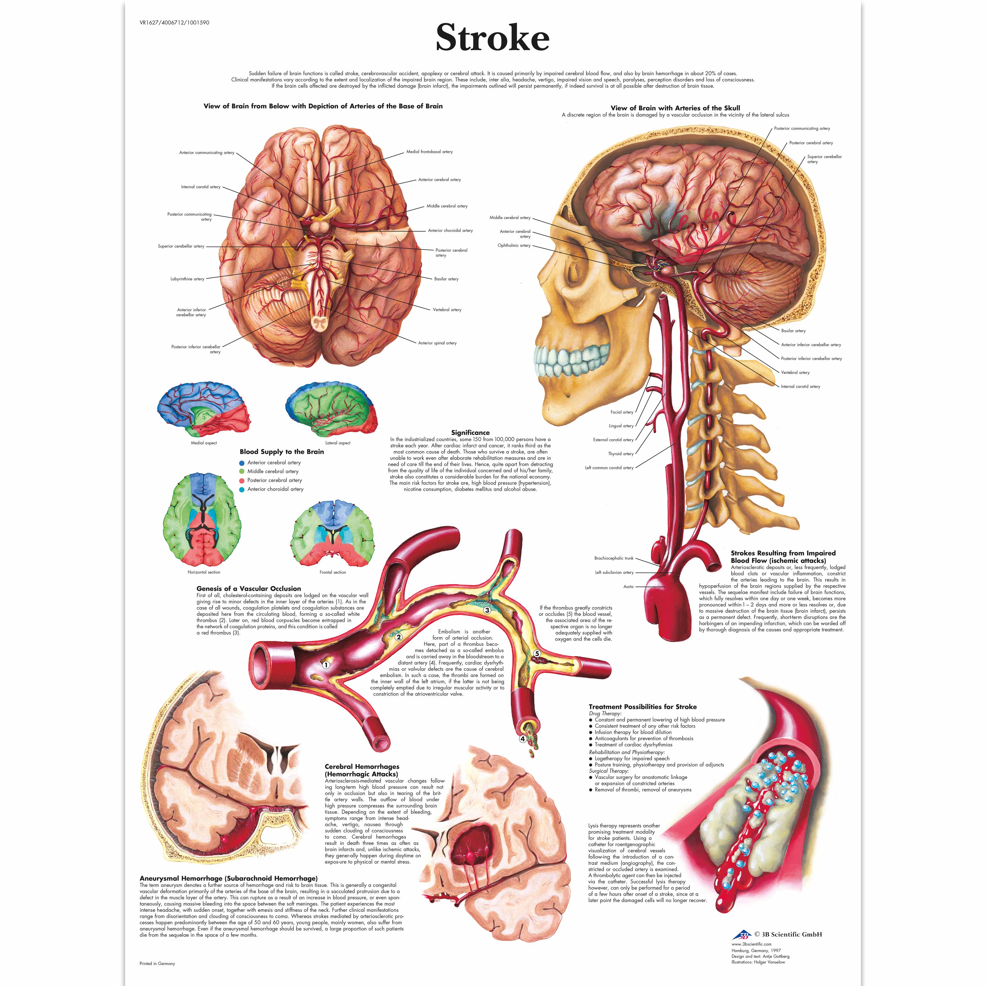 Anatomy Charts Posters Understanding Stroke Anatomical Chart Nd Sexiz Pix
