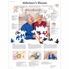 Alzheimer's Disease, 1001592 [VR1628L], Плакаты по мозгу и нервной системе