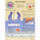 HIV and AIDS Chart, 4006722 [VR1725UU], 기생충, 바이러스 및 박테리아 감염