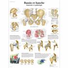 Bassin et hache - Anatomie et pathologie, 4006742 [VR2172UU], Плакаты по опорно-двигательному аппарату человека