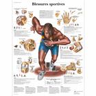 Blessures sportives, 4006746 [VR2188UU], Плакаты по мышечной системе