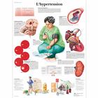 L'hypertension, 1001699 [VR2361L], 心血管系统