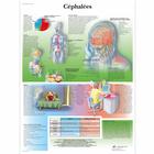 Céphalées, 4006801 [VR2714UU], Плакаты по мозгу и нервной системе