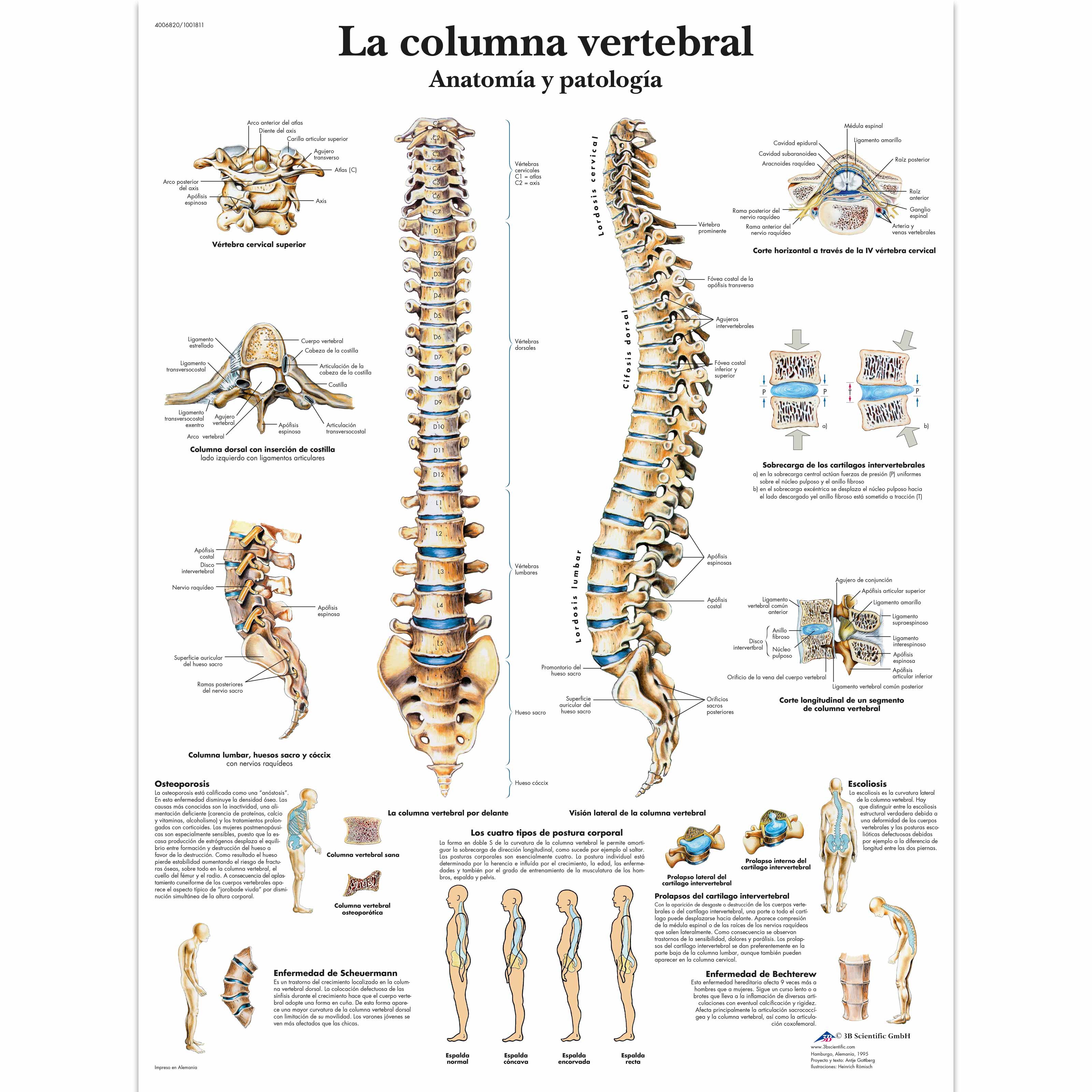 La columna vertebral - Anatomía y patología - 1001811 - VR3152L - Skeletal  System - 3B Scientific