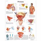 Próstata, 4006862 [VR3528UU], Плакаты по мочеполовой системе