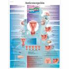 Lehrtafel - Contraception, 1001909 [VR3591L], Плакаты по гинекологии