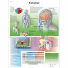 Cefaleas, 4006881 [VR3714UU], 大脑和神经系统