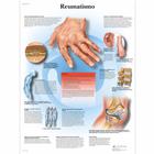 Reumatismo, 4006900 [VR4124UU], Sistema Esqueletico