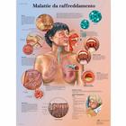 Lehrtafel - Malattie da raffreddamento, 1002007 [VR4253L], Atmungssystem