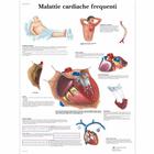 Malattie cardiache frequenti, 4006928 [VR4343UU], 心脏健康和身体健康教育示意图