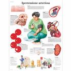 Ipertensione arteriosa, 4006931 [VR4361UU], système cardiovasculaire