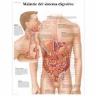 Malattie del sistema digestívo, 4006939 [VR4431UU], El sistema digestivo