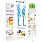 Медицинский плакат "Остеопороз", 1002215 [VR6121L], Sistema Esquelético