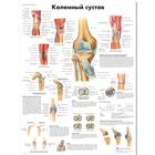 Медицинский плакат "Коленный сустав", 1002230 [VR6174L], Sistema Esqueletico