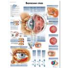 Медицинский плакат "Болезни глаз", 1002239 [VR6231L], Yeux