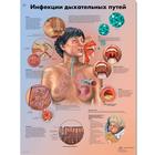 Медицинский плакат "Инфекции дыхательных путей", 1002249 [VR6253L], Sistema Respiratorio