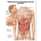 Медицинский плакат "Заболевания пищеварительной системы", 1002290 [VR6431L], El sistema digestivo