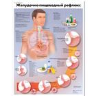 Медицинский плакат "Желудочно-пищевой рефлюкс", 1002343 [VR6711L], El sistema digestivo