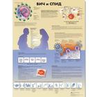 Медицинский плакат "ВИЧ и СПИД", 1002351 [VR6725L], Parasitaires, virales ou Infection bactérienne