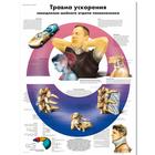 Медицинский плакат "Травма ускорения шейного отдела позвоночника", 1002355 [VR6761L], système Squelettique