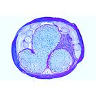 The Ascaris megalocephala Embryology - Spanish, 1013481 [W13086], Lames microscopiques Espagnol