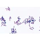 Bakterien als Krankheits- und Seuchenerreger - Deutsch, 1004146 [W13324], Mikropräparate LIEDER