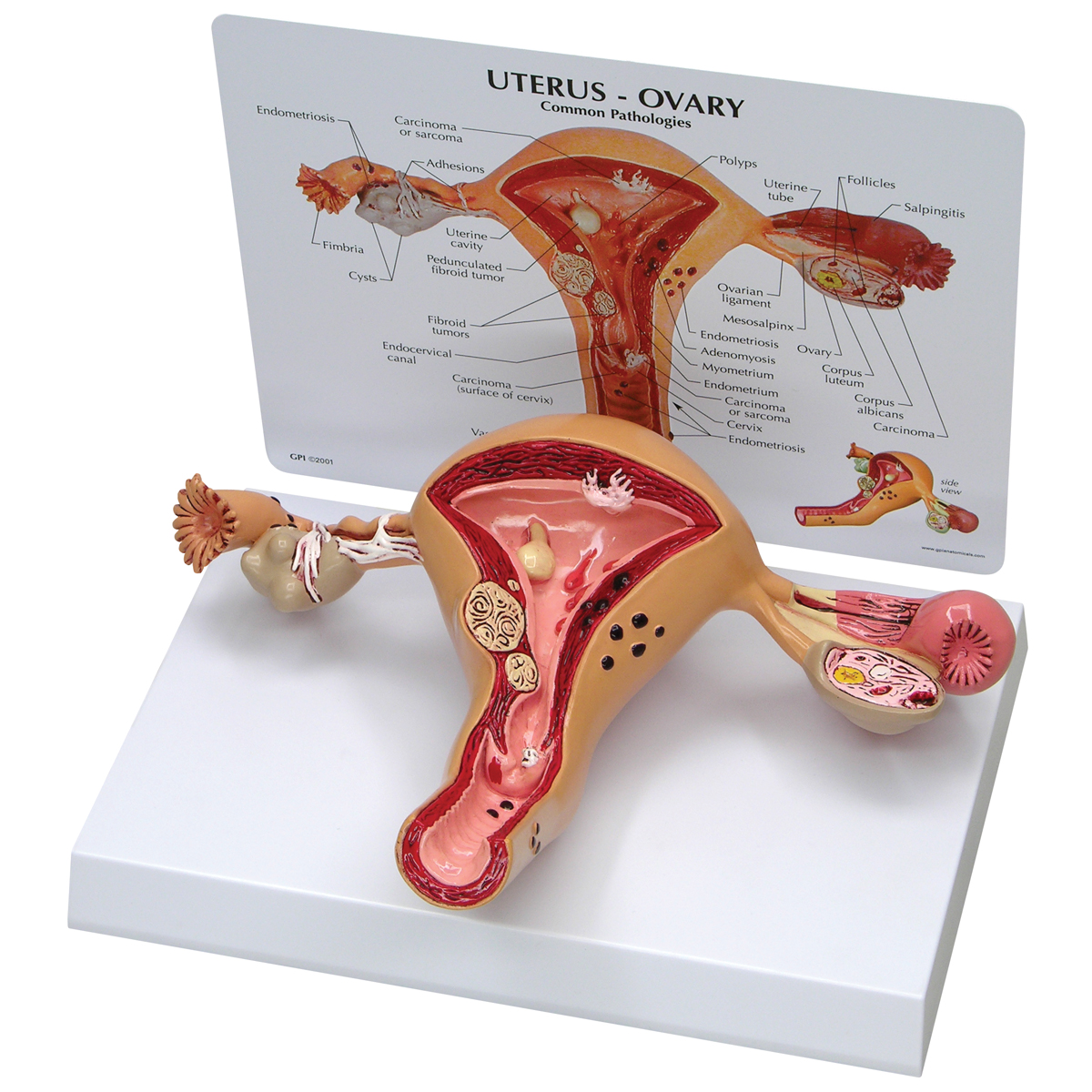 Total 42+ imagen modelo de utero