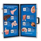 The Consequences of Obesity 3D Display, 3004616 [W43057], Education alimentaire