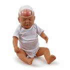 Демонстрационная модель синдрома детского сотрясения, 1017928 [W43117], Тренажеры и симуляторы по уходу за новорожденными
