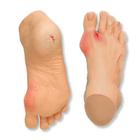 Common Foot Problems Model, 3004419 [W44729], Outils d’éducation au diabète