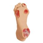 Elderly Pressure Ulcer Foot, 1013058 [W44757], Medical Simulators