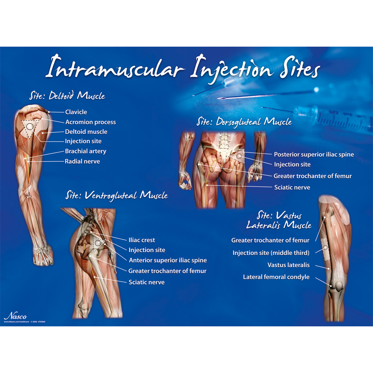 근육 주사 부위 포스터 - 1018427 - W44783 - Life/Form - Lf00695 - Intramuscular  (I.M.) And Intradermal 근육 및 피내 - 3B Scientific