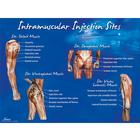 Póster de puntos de inyección intramuscular, 1018427 [W44783], Inyecciones y punción