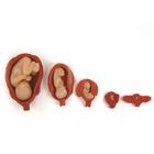 Uterus/Fetus Model Set (5), 3004840 [W99999-509], Educación para salud femenina